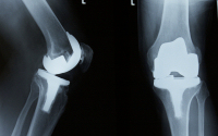 machined components for medical applications